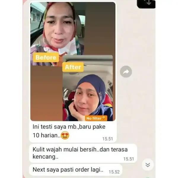 Testimoni 1