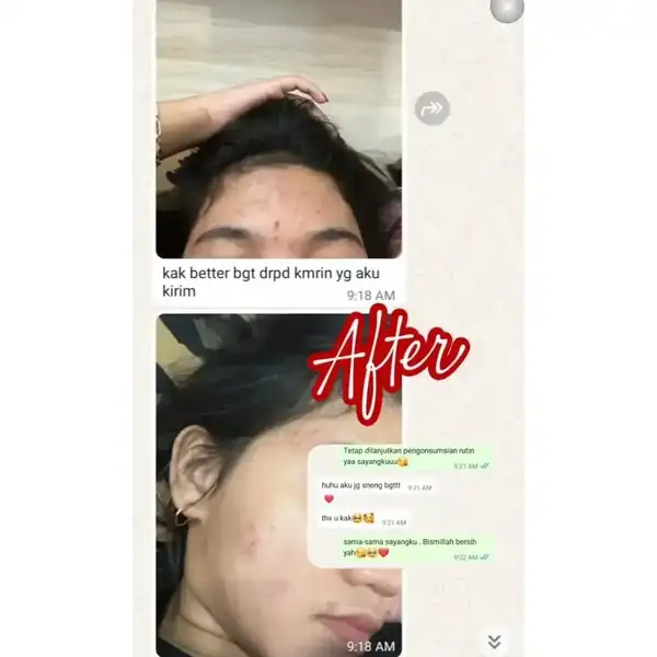Testimoni 5